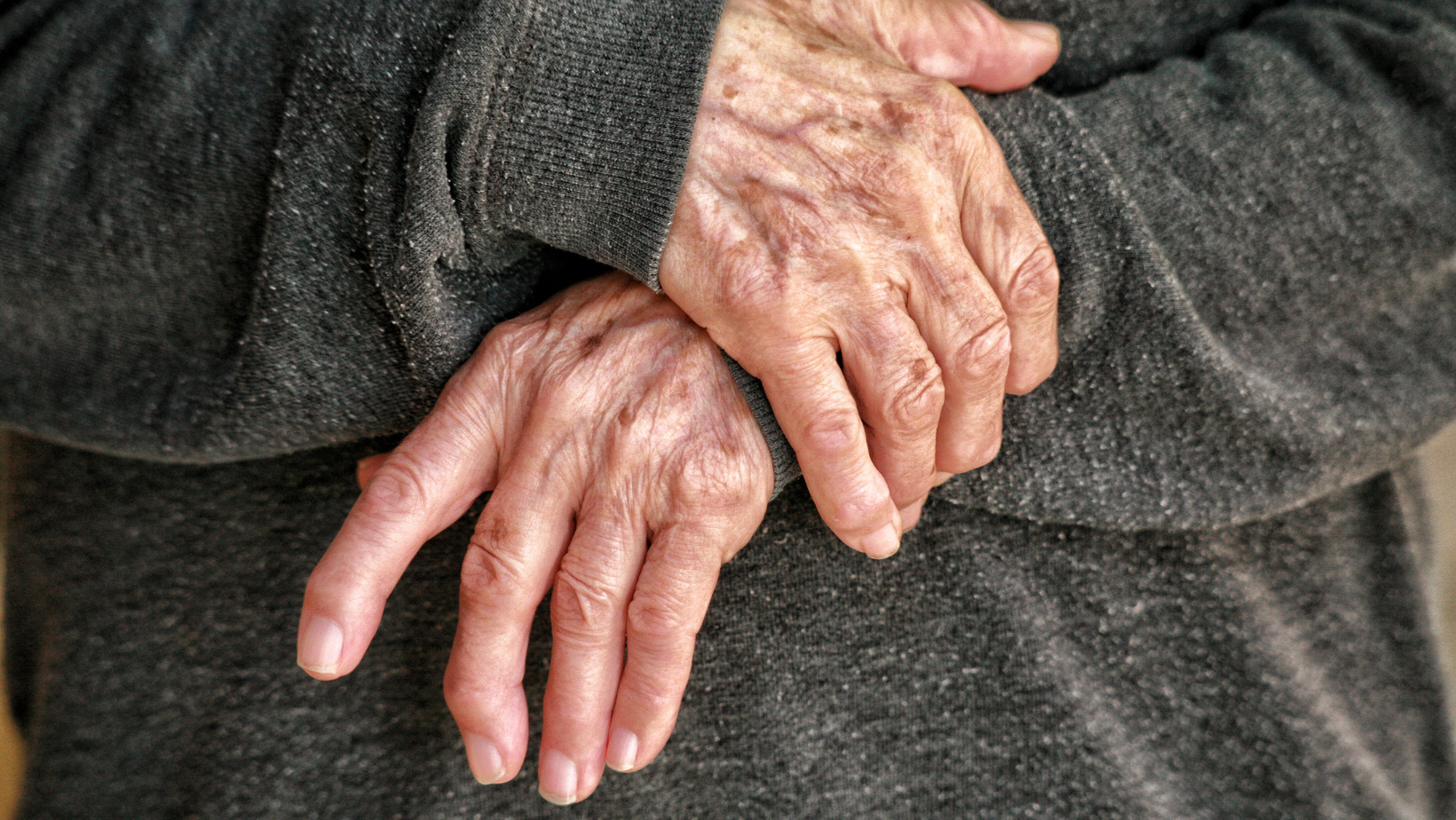 vrouw met pijnlijke gewrichten in hand door artrose behandeld door chiropractor specialist in artrose